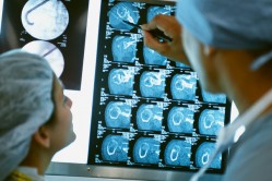 Physicians Examining MRI Results