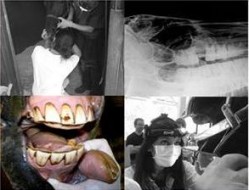 odontologia-equina